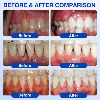 🦷🛡️𝐇𝐄𝐀𝐓𝐖𝐎𝐋𝐅® GumRevive Periodontal Repair Gel