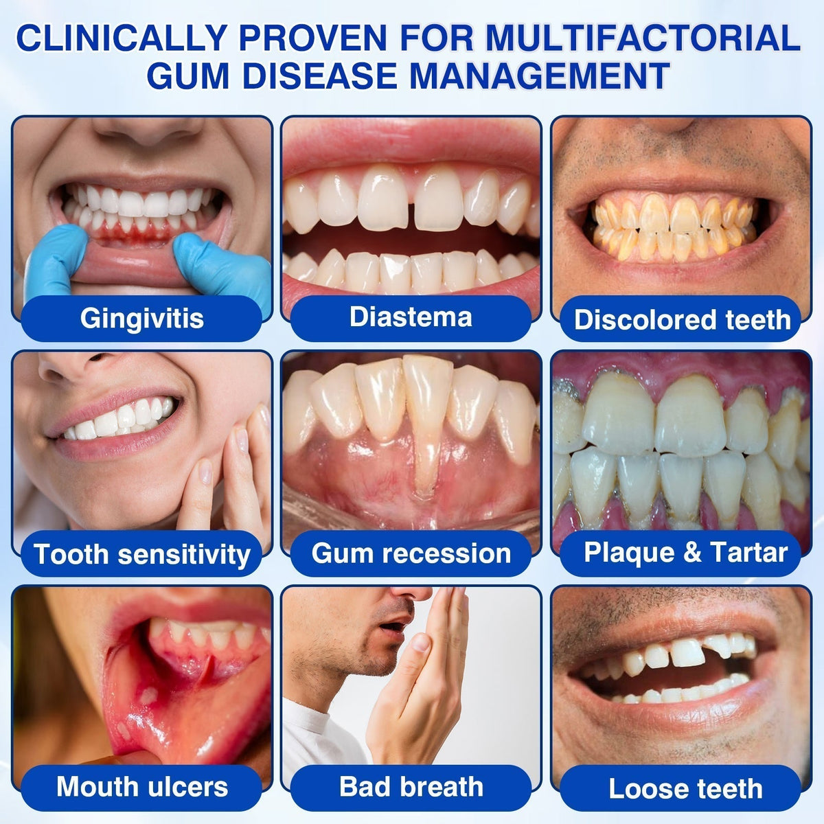 🦷🛡️𝐇𝐄𝐀𝐓𝐖𝐎𝐋𝐅® GumRevive Periodontal Repair Gel