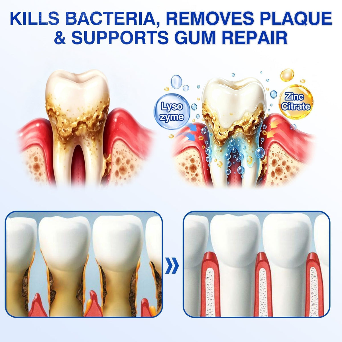 🦷🛡️𝐇𝐄𝐀𝐓𝐖𝐎𝐋𝐅® GumRevive Periodontal Repair Gel