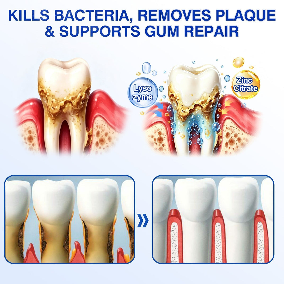 🏅🦷🛡️𝐇𝐄𝐀𝐓𝐖𝐎𝐋𝐅® GumRevive Periodontal Repair Gel