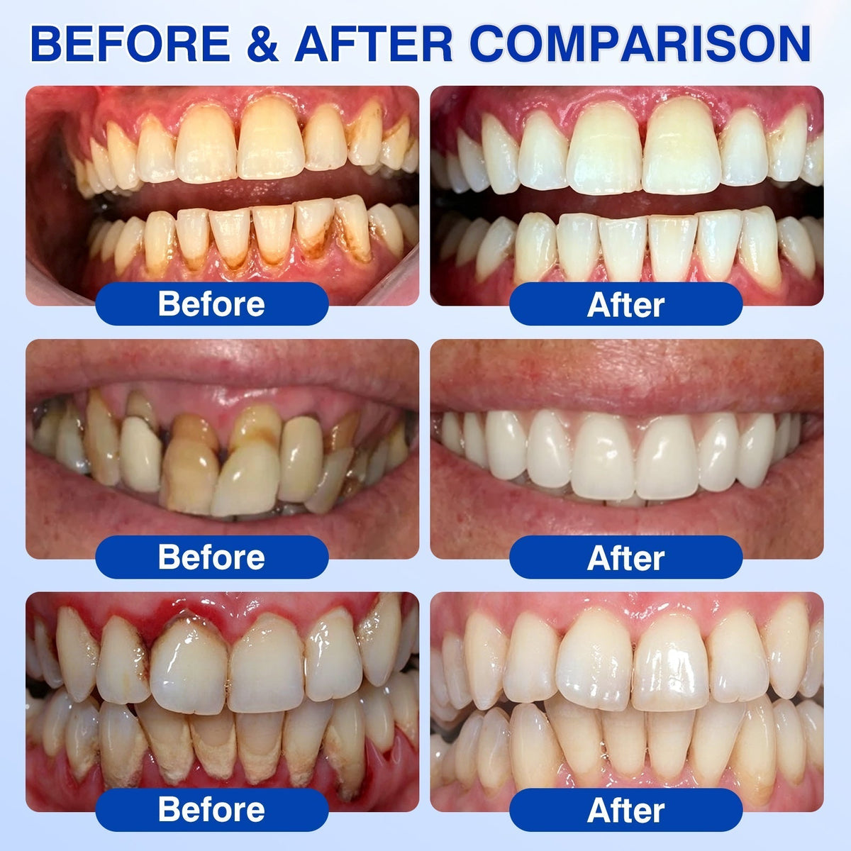 🏅🦷🛡️𝐇𝐄𝐀𝐓𝐖𝐎𝐋𝐅® GumRevive Periodontal Repair Gel