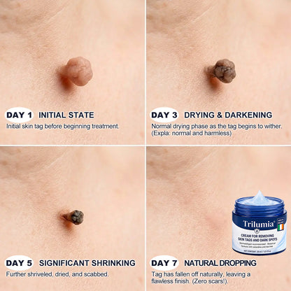 𝐏𝐡𝐚𝐫𝐦𝐚𝐜𝐢𝐬𝐭 𝐑𝐞𝐜𝐨𝐦𝐦𝐞𝐧𝐝𝐞𝐝🥇Trilumia® 7-𝐃𝐚𝐲 𝐒𝐤𝐢𝐧 𝐓𝐚𝐠 & 𝐒𝐩𝐨𝐭 𝐄𝐫𝐚𝐬𝐞𝐫 𝐂𝐫𝐞𝐚𝐦 🍀(Zero Pain, Zero 𝐒𝐜𝐚𝐫𝐬 Formula)