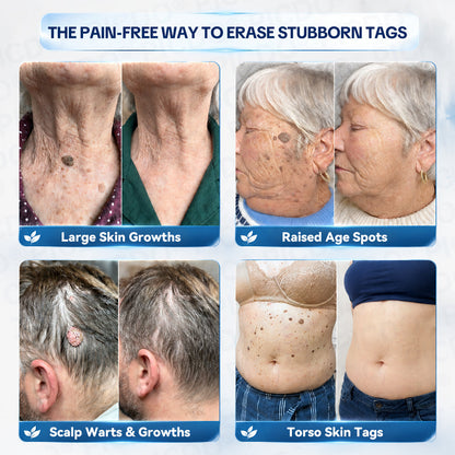 𝐏𝐡𝐚𝐫𝐦𝐚𝐜𝐢𝐬𝐭 𝐑𝐞𝐜𝐨𝐦𝐦𝐞𝐧𝐝𝐞𝐝👨🏻‍⚕️𝐏𝐢𝐜𝐝𝐨® 7-𝐃𝐚𝐲 𝐒𝐤𝐢𝐧 𝐓𝐚𝐠 & 𝐒𝐩𝐨𝐭 𝐄𝐫𝐚𝐬𝐞𝐫 𝐂𝐫𝐞𝐚𝐦 🍀(Zero Pain, Zero 𝐒𝐜𝐚𝐫𝐬 Formula)