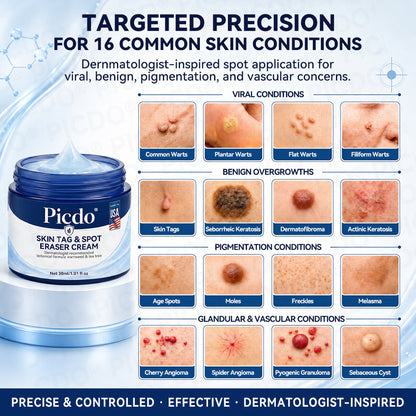 𝐏𝐡𝐚𝐫𝐦𝐚𝐜𝐢𝐬𝐭 𝐑𝐞𝐜𝐨𝐦𝐦𝐞𝐧𝐝𝐞𝐝👨🏻‍⚕️𝐏𝐢𝐜𝐝𝐨® 7-𝐃𝐚𝐲 𝐒𝐤𝐢𝐧 𝐓𝐚𝐠 & 𝐒𝐩𝐨𝐭 𝐄𝐫𝐚𝐬𝐞𝐫 𝐂𝐫𝐞𝐚𝐦 🍀(Zero Pain, Zero 𝐒𝐜𝐚𝐫𝐬 Formula)